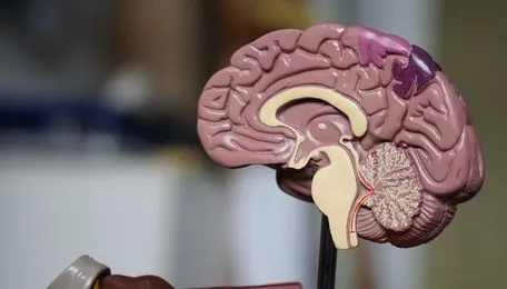 Intraoperative imaging